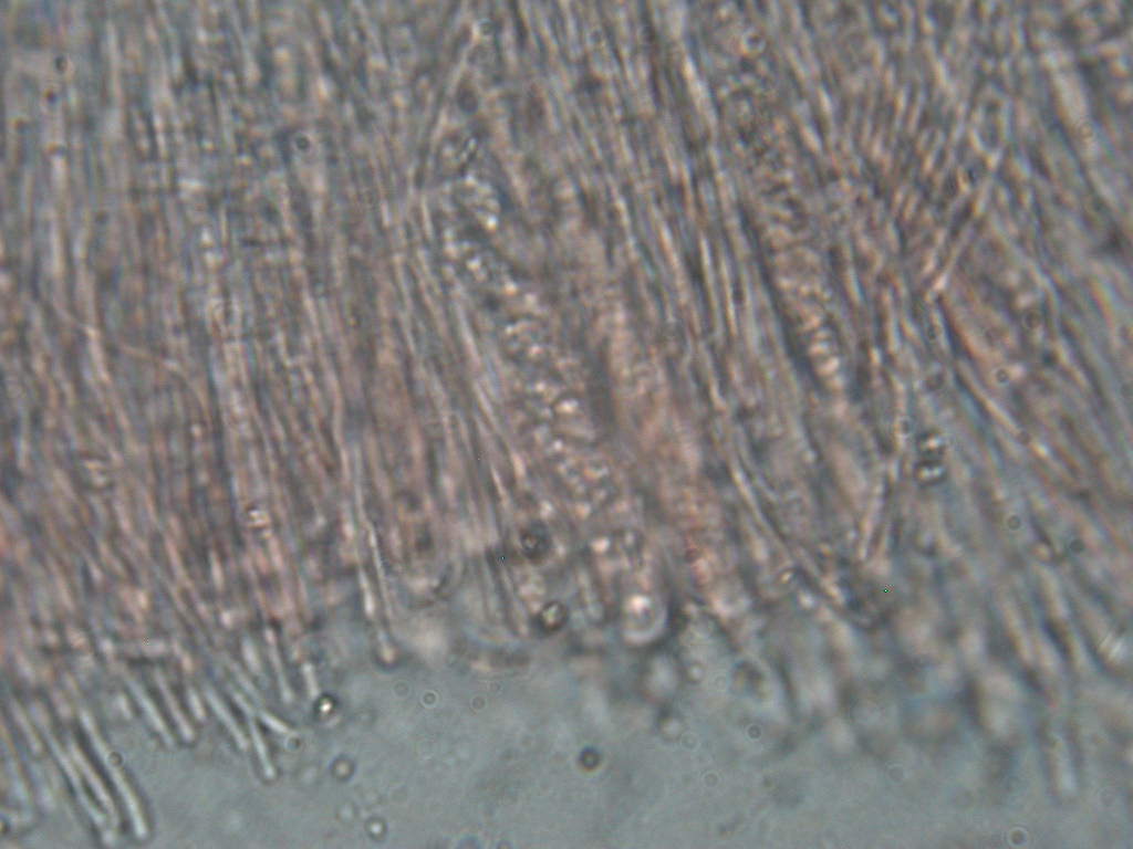 Sconosciuto (cfr. Ascocoryne sp.)